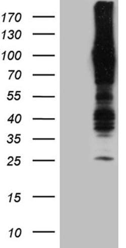 APBB1IP Mouse anti-Human, Clone: OTI1F2, lyophilized, TrueMAB 100 &mu;g;