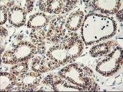 APBB3 Mouse anti-Human, Clone: OTI5G3, lyophilized, TrueMAB 100 &mu;g;