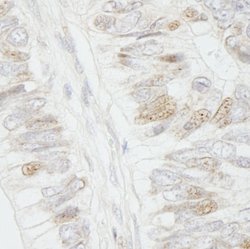 APC Polyclonal Antibody, Bethyl Laboratories 100 &mu;l; Unlabeled:Antibodies,