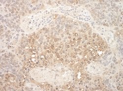 APC7 Polyclonal Antibody, Bethyl Laboratories:Antibodies:Primary Antibodies