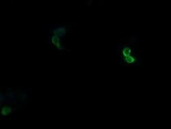 APCS Monoclonal Antibody (OTI5A9), TrueMAB , OriGene:Antibodies:Primary