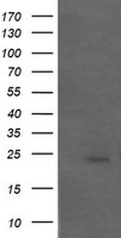 APCS Monoclonal Antibody (OTI5A9), TrueMAB , OriGene:Antibodies:Primary