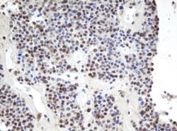 APEX1 Monoclonal Antibody (OTI1H9), TrueMAB , OriGene 100 &mu;L; Unconjugated:Antibodies,