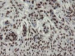 APEX1 Mouse anti-Human, Clone: OTI6E10, lyophilized, TrueMAB 100 &mu;g;