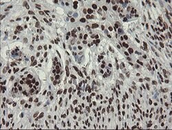 APEX1 Monoclonal Antibody (OTI6E10), TrueMAB , OriGene 100 &mu;L; Unconjugated:Antibodies,