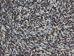 APEX1 Mouse anti-Human, Clone: OTI6E10, lyophilized, TrueMAB 100 &mu;g;