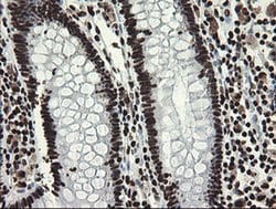 APEX1 Monoclonal Antibody (OTI6E10), TrueMAB , OriGene 100 &mu;L; Unconjugated:Antibodies,
