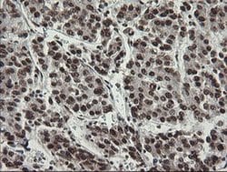 APEX1 Monoclonal Antibody (OTI6E10), TrueMAB , OriGene 100 &mu;L; Unconjugated:Antibodies,