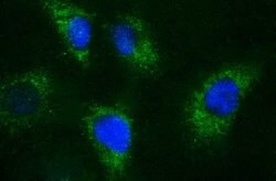 APOA5 Mouse anti-Human, Clone: OTI1E3, lyophilized, TrueMAB 100 &mu;g | Buy Online | Origene Technologies | Fisher Scientific