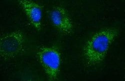 APOA5 Monoclonal Antibody (OTI1E3), TrueMAB , OriGene 100 &mu;L; Unconjugated:Antibodies,