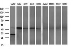 APOA5 Monoclonal Antibody (OTI1E3), TrueMAB , OriGene 100 &mu;L; Unconjugated:Antibodies,
