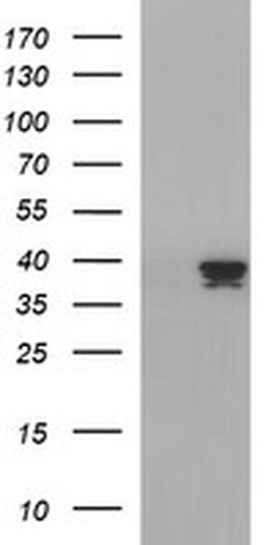 APOA5 Monoclonal Antibody (OTI2B11), TrueMAB , OriGene 100 &mu;L; Unconjugated:Antibodies,