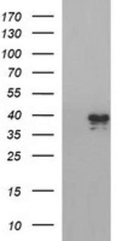 APOA5 Mouse anti-Human, Clone: OTI3A5, lyophilized, TrueMAB 100 &mu;g | Buy Online | Origene Technologies | Fisher Scientific