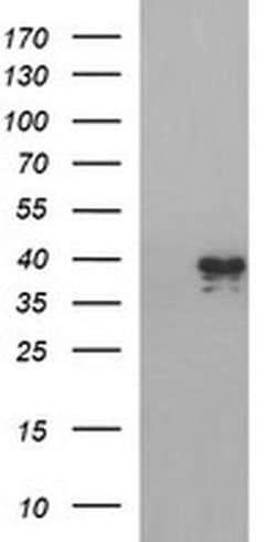 APOA5 Monoclonal Antibody (OTI3A5), TrueMAB , OriGene 100 &mu;L; Unconjugated:Antibodies,