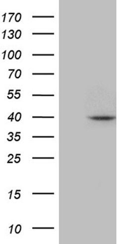 APOBEC4 Monoclonal Antibody (OTI2A6), TrueMAB , OriGene 30 &mu;L | Buy Online | Origene Technologies | Fisher Scientific