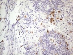 APOBR Monoclonal Antibody (OTI1B5), TrueMAB , OriGene 100 &mu;L; Unconjugated:Antibodies,