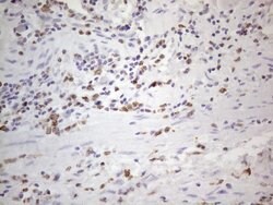 APOBR Monoclonal Antibody (OTI1B5), TrueMAB , OriGene 100 &mu;L; Unconjugated:Antibodies,