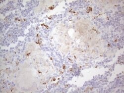 APOBR Monoclonal Antibody (OTI1B5), TrueMAB , OriGene 100 &mu;L; Unconjugated:Antibodies,