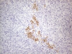 APOBR Monoclonal Antibody (OTI1B5), TrueMAB , OriGene 100 &mu;L; Unconjugated:Antibodies,