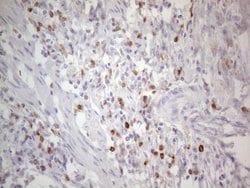 APOBR Monoclonal Antibody (OTI1B5), TrueMAB , OriGene 100 &mu;L; Unconjugated:Antibodies,