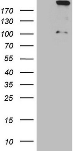 APOBR Monoclonal Antibody (OTI1B5), TrueMAB , OriGene 100 &mu;L; Unconjugated:Antibodies,