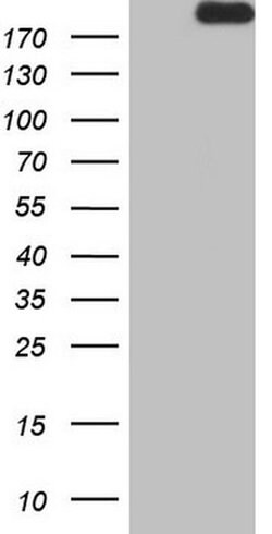 APOBR Monoclonal Antibody (OTI3D11), TrueMAB , OriGene 100 &mu;L; Unconjugated:Antibodies,