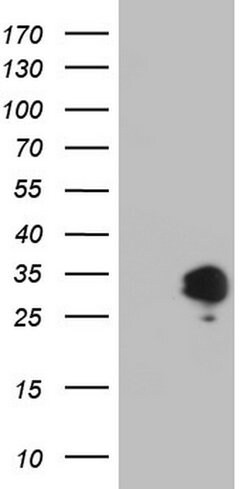 APOE Monoclonal Antibody (OTI1H6), TrueMAB , OriGene 100 &mu;L; Unconjugated:Antibodies,