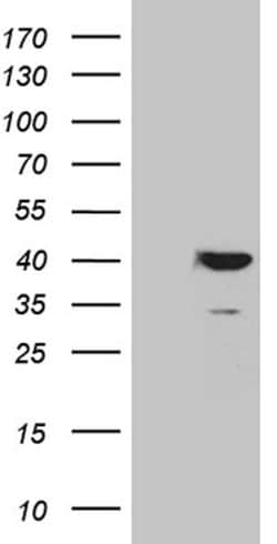 APOL1 Monoclonal Antibody (OTI3D9), TrueMAB , OriGene 100 &mu;L; Unconjugated:Antibodies,
