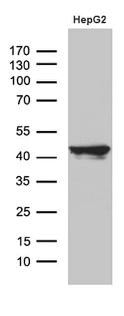 APOL1 Monoclonal Antibody (OTI5E10), TrueMAB , OriGene 30 &mu;L; Unconjugated:Antibodies,
