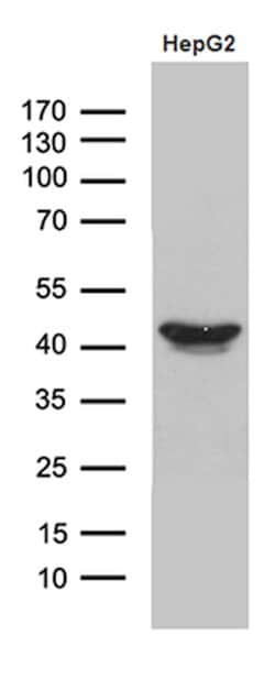 APOL1 Monoclonal Antibody (OTI8B7), TrueMAB , OriGene 100 &mu;L; Unconjugated:Antibodies,