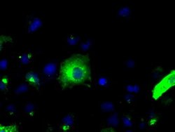 APP Monoclonal Antibody (OTI7G9), TrueMAB , OriGene 100 &mu;L; Unconjugated:Antibodies,