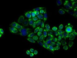 APP Mouse anti-Human, Clone: OTI2B10, lyophilized, TrueMAB 100 &mu;g; Unconjugated:Antibodies,