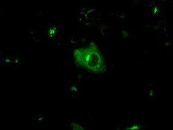 APP Mouse anti-Human, Clone: OTI6B7, lyophilized, TrueMAB 100 &mu;g; Unconjugated:Antibodies,