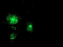 APP Mouse anti-Human, Clone: OTI6F11, lyophilized, TrueMAB 100 &mu;g; Unconjugated:Antibodies,