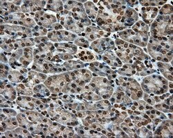 APP Mouse anti-Human, Clone: OTI2B10, lyophilized, TrueMAB 100 &mu;g; Unconjugated:Antibodies,