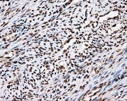APP Mouse anti-Human, Clone: OTI2B10, lyophilized, TrueMAB 100 &mu;g; Unconjugated:Antibodies,