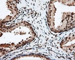 APP Mouse anti-Human, Clone: OTI2B10, lyophilized, TrueMAB 100 &mu;g; Unconjugated:Antibodies,
