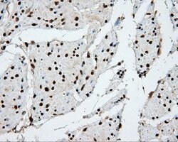 APP Mouse anti-Human, Clone: OTI2B10, lyophilized, TrueMAB 100 &mu;g; Unconjugated:Antibodies,