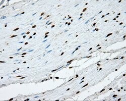 APP Mouse anti-Human, Clone: OTI2B10, lyophilized, TrueMAB 100 &mu;g; Unconjugated:Antibodies,