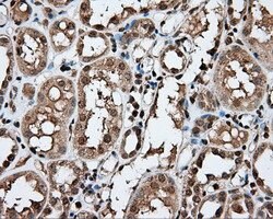 APP Mouse anti-Human, Clone: OTI2B10, lyophilized, TrueMAB 100 &mu;g; Unconjugated:Antibodies,