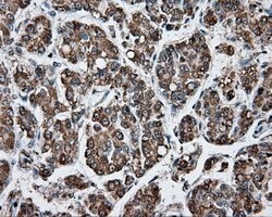 APP Mouse anti-Human, Clone: OTI2B10, lyophilized, TrueMAB 100 &mu;g; Unconjugated:Antibodies,