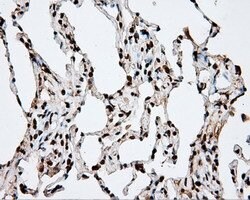 APP Mouse anti-Human, Clone: OTI2B10, lyophilized, TrueMAB 100 &mu;g; Unconjugated:Antibodies,
