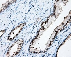 APP Mouse anti-Human, Clone: OTI7B8, lyophilized, TrueMAB 100 &mu;g; Unconjugated:Antibodies,