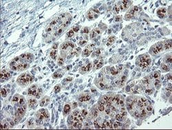 APP Monoclonal Antibody (OTI7A10), TrueMAB , OriGene 30 &mu;L; Unconjugated:Antibodies,