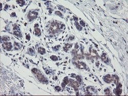 APP Mouse anti-Human, Clone: OTI6F11, lyophilized, TrueMAB 100 &mu;g; Unconjugated:Antibodies,