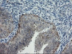APP Mouse anti-Human, Clone: OTI6F11, lyophilized, TrueMAB 100 &mu;g; Unconjugated:Antibodies,