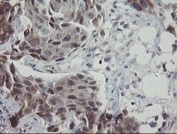 APP Mouse anti-Human, Clone: OTI6F11, lyophilized, TrueMAB 100 &mu;g; Unconjugated:Antibodies,