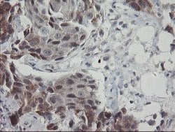 APP Monoclonal Antibody (OTI6F11), TrueMAB , OriGene 100 &mu;L; Unconjugated:Antibodies,