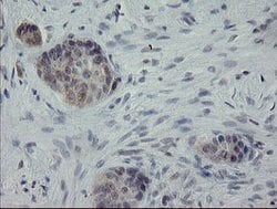 APP Mouse anti-Human, Clone: OTI6F11, lyophilized, TrueMAB 100 &mu;g; Unconjugated:Antibodies,