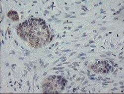 APP Monoclonal Antibody (OTI6F11), TrueMAB , OriGene 100 &mu;L; Unconjugated:Antibodies,